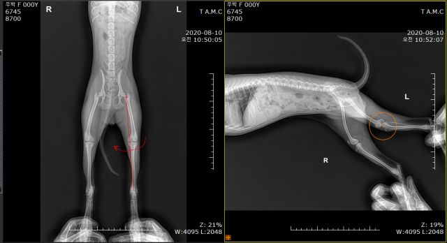 우박이의 X-ray 소견 상 성장하면서 대퇴골과 경골의 변위가 심해질 것임을 예측할 수 있으며 그로 인해 내측 슬개골 탈구도 더 진행될 수 있음을 보호자에게 설명했다(좌측 사진). 우측 슬관절에 비해 좌측 무릎관절의 형태학적인 변형이 심해지고 있음을 확인했다(우측사진). 탑스동물메디컬센터 제공.