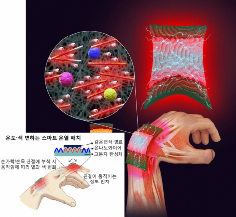 관절에 부착해 손상 조직의 수축과 이완을 돕는 스마트 패치가 포스텍 공동연구팀에 의해 개발됐다. 포스텍 제공