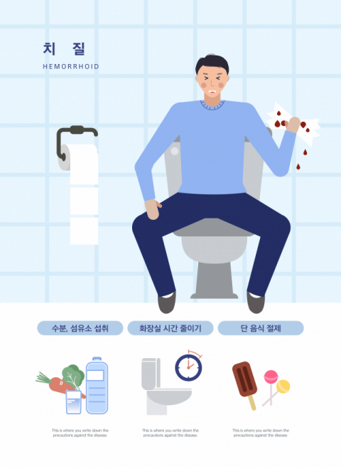 [건강플러스] ⑩활동 줄어든 코로나 시대, 심해지는 치질