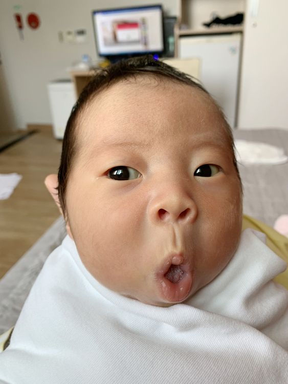 김나영 산모 아기