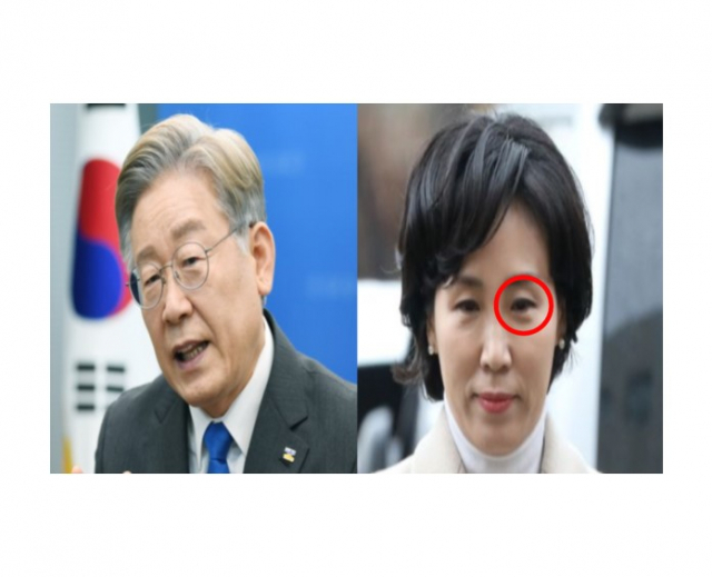 이재명 민주당 대선 후보(왼쪽)와 그의 아내 김혜경 씨. 김혜경 씨가 지난 9일 새벽 실신해 넘어지면서 왼쪽 눈썹 위 2.5cm 정도가 찢어지는 상처를 입어 온갖 억측이 난무하는 상황이 빚어졌다. 매일신문DB
