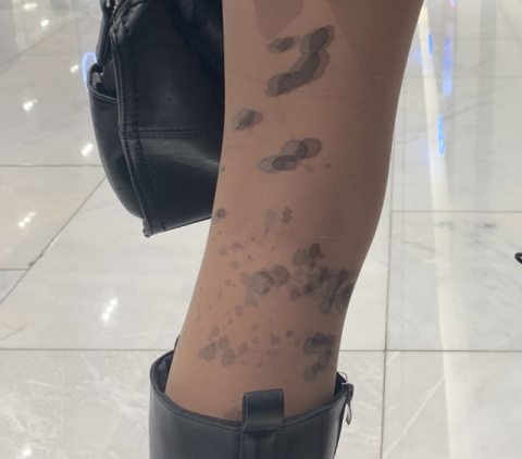 지난 2월 대구 도심에서 한 남성이 여성들에게 검은 액체를 뿌리고 달아난 사건이 발생했다. 트위터 캡처