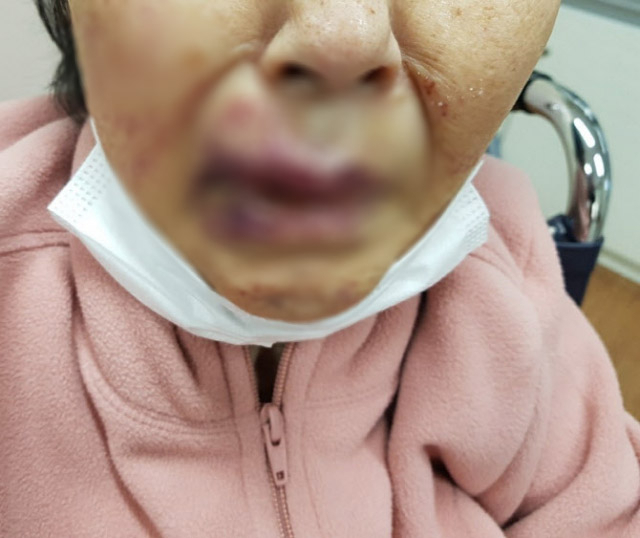 A씨가 공개한 할머니의 폭행 당시 사진. 온라인 커뮤니티 캡처