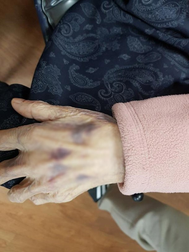 A씨가 공개한 할머니의 폭행 당시 사진. 온라인 커뮤니티 캡처
