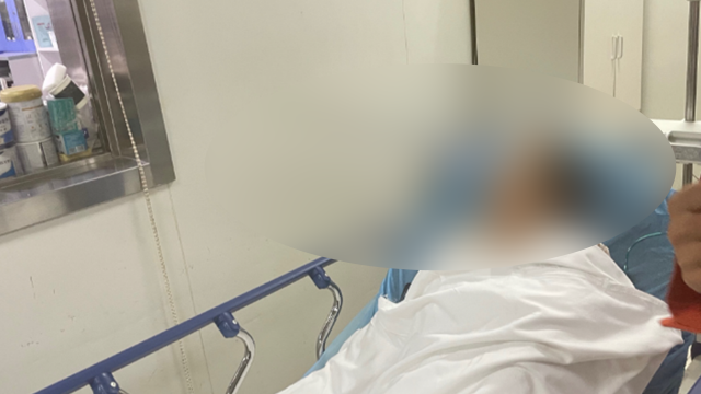 중국에서 갑자기 날아온 80㎝ 길이의 화살이 산책하던 중년 여성의 눈 주위에 맞는 사건이 발생했다. 항저우넷