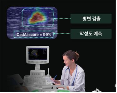 빔웍스가 개발한 유방암 자동 진단 솔루션 자료사진. 대구시 제공