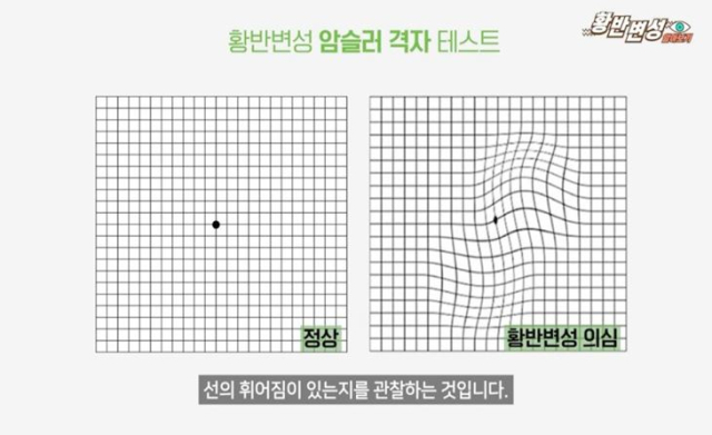 황반변성 자가테스트. 칠곡경북대병원 제공