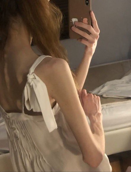 청소년들이 모인 프로아나 오픈채팅방에서 다이어트 의지를 북돋우기 위해 공유하는 사진. 출처 프로아나 오픈채팅방