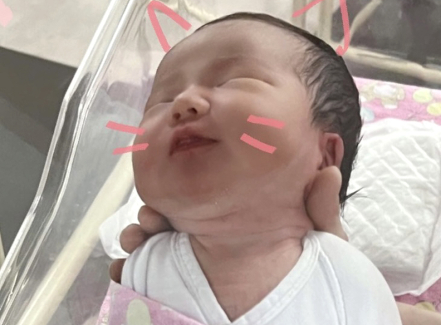 김지연 산모 아기