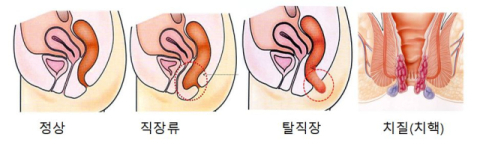 [건강플러스] 