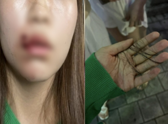 대전에서 여성 1명 남성 2명으로부터 무차별 폭행을 당했다는 피해여성 B씨. 온라인 커뮤니티 캡처