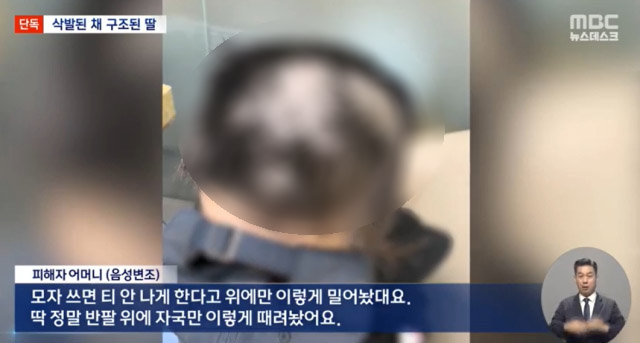 여자친구를 감금하고 폭행·강간을 저지른 남성이 구속된 가운데, 해당 남성의 가혹행위가 담긴 공소장이 공개됐다. MBC 보도 캡처