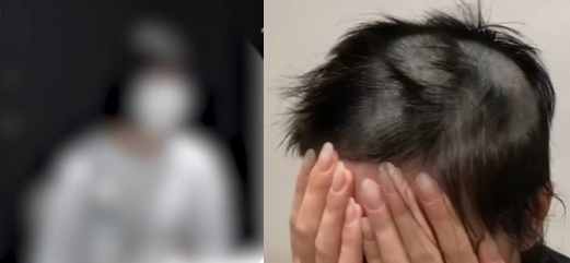 남자친구에게 바리캉으로 머리를 밀리고 폭행성폭행을 당한 피해자의 모습. 유튜브 