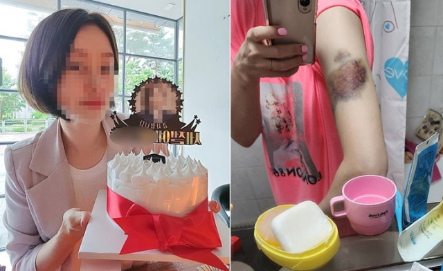 피해자의 살아생전 모습(왼쪽)과 폭행 피해로 멍이 든 모습.