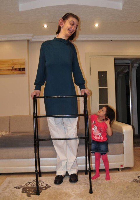 [World No.1]<86>세계에서 제일 큰 여자 ‘루미사 겔기’ 2m15cm 