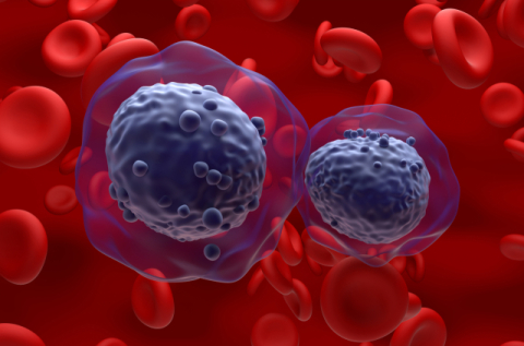 [건강플러스] 증가하는 혈액암 환자…치료법 발달로 완치 가능성 높인다