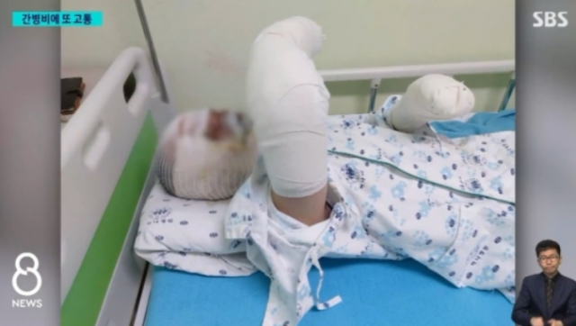 지난 9월 부산 동구 목욕탕 폭발 사고 당시 화재 진압에 나섰다가 전신화상을 입은 소방관과 경찰관 등이 간병비 지원금 부족 문제로 어려움을 겪고 있다고 토로했다. SBS 보도 화면 캡처