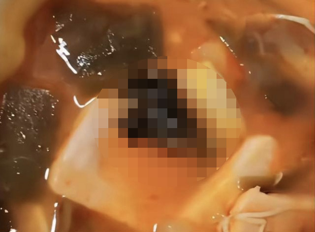 중국에서 판매되는 즉석 마라탕에서 박쥐 날갯죽지가 나왔다는 주장이 제기됐다. 극목신문