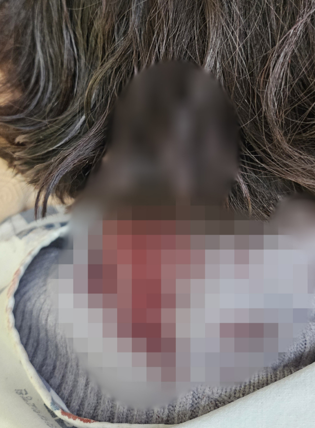 배현진 의원 피습 직후 촬영된 사진. 회색 니트의 목주변에 다량의 혈흔이 묻어 있다. 연합뉴스