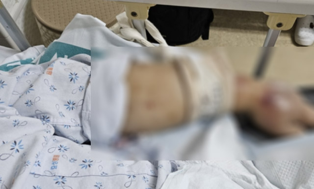 충북 청주의 한 치매 환자가 요양원에 입소한 지 2주 만에 패혈증에 걸려 사망하는 사고가 발생했다. 유족 제공=연합뉴스