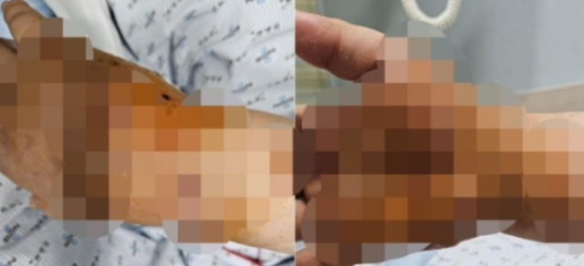 대리운전 기사가 고객의 차량 안에 있던 맹견 