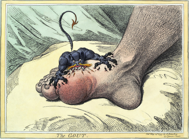 통풍의 고통을 표현한 19세기 그림. 클립아트코리아 제공.
