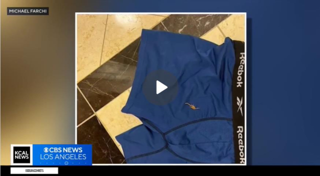 미국 라스베이거스 호텔에서 전갈에 쏘였다고 주장한 남성이 속옷에 달라붙은 전갈 사진을 공개했다. KCAL뉴스 방송 장면 캡처