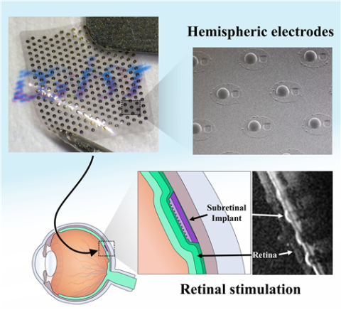 DGIST, 실명 환자 시력 회복 3차원 망막 전극 개발