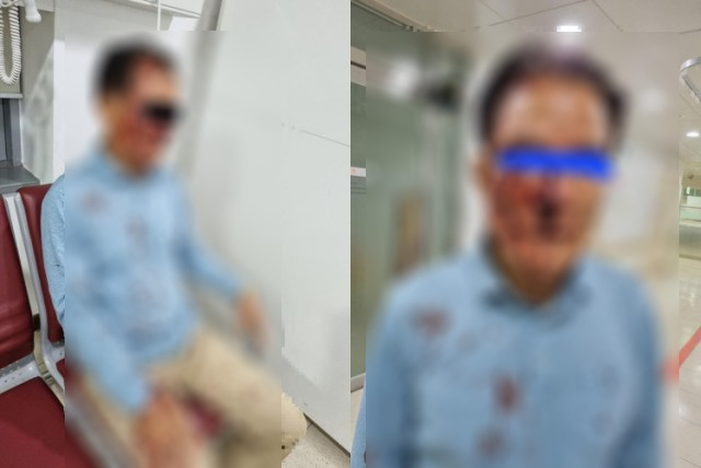 승객에게 폭행을 당한 70대 택시 기사. 보배드림 캡처