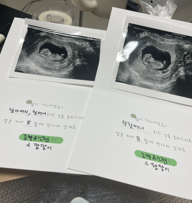 임밍아웃 사실을 카드로 전달하는 방법도 있다. 카드 안에 초음파 사진을 붙이고