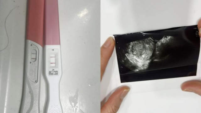 현직 프로야구 선수가 여성 팬과 교제 중 낙태를 강요했다는 글이 온라인 커뮤니티에 퍼지며 논란이 일고 있다. 온라인 커뮤니티 캡처