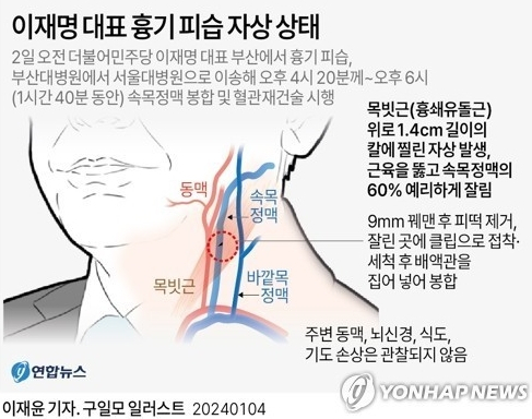 이재명 대표 흉기 피습 자상 상태. 연합뉴스