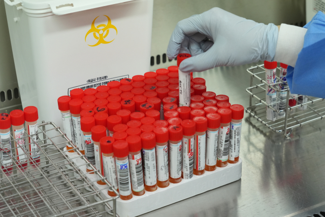대구 시내 한 종합병원 코로나19 PCR 검사실에서 직원이 증상자들로부터 채취한 검체를 정리하고 있다. 안성완 기자 asw0727@imaeil.com
