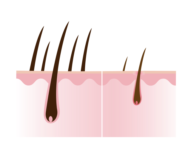 모발 관련 자료 이미지. 게티이미지뱅크