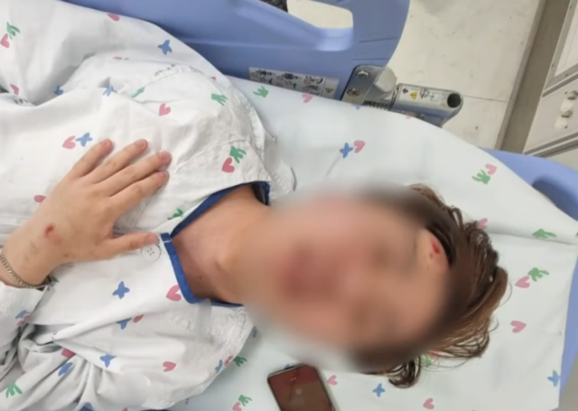 귀가 중이던 고등학교 3학년 학생이 무차별 폭행 당하는 사건이 발생했다. 사진은 일면식도 없는 남성에게 무차별 폭행을 당한 고등학교 3학년 학생의 모습. JTBC 