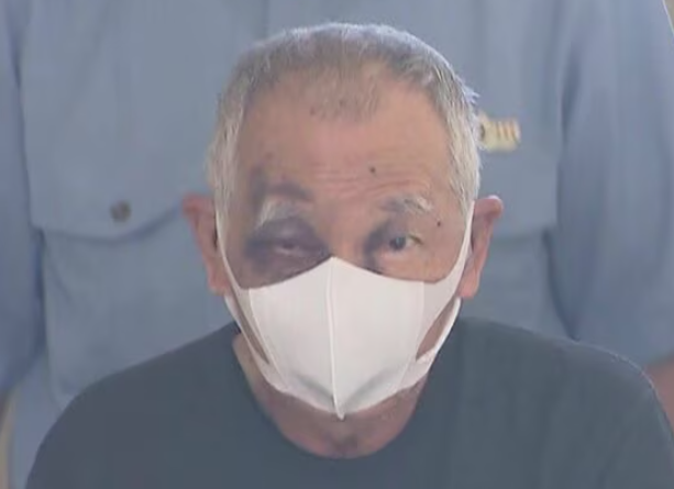 50대 아들에게 흉기를 휘둘러 살해하려 한 혐의로 체포된 70대 남성 A씨. 눈가에는 선명한 멍자국이 보인다. /FNN