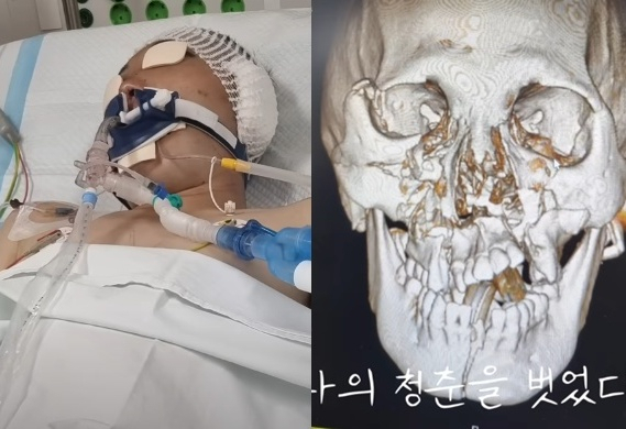 군 복무 중 사고를 당한 안태랑 씨. /유튜브