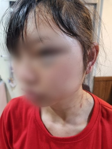 폭행당한 이주노동자. 연합뉴스.