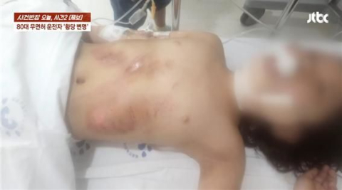 무면허로 초등생 쳐 안면골절 시킨 80대男 