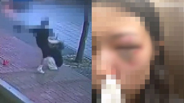 태권도 선수인 남자친구로부터 폭행을 당한 여성이 공개한 사건 당시 CCTV 화면(왼쪽)과 부상입은 모습. JTBC 사건반장 보도화면 캡처