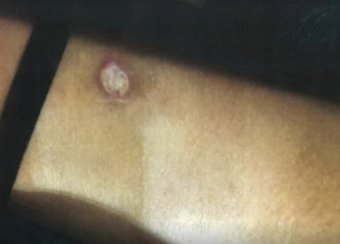 '솜방망이' 학폭위 이후 숨진 피해 여고생…장례식서 드러난 '성폭행 정황'