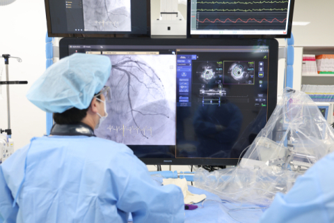 계명대동산병원, 지역 최초 차세대 혈관내 초음파(IVUS) 장비 '아비고 플러스' 도입
