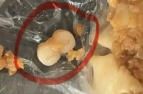 음식에서 치아가 왜나와?…中 소시지·딤섬·케이크 먹다 '날벼락'