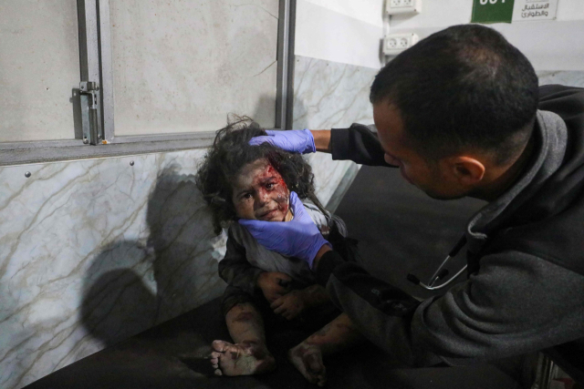 29일(현지시간) 가자지구 중부 누세이라트의 알아우다 병원에서 의료진이 이스라엘 공습으로 부상을 입은 어린 소녀를 치료하고 있다. AFP 연합뉴스