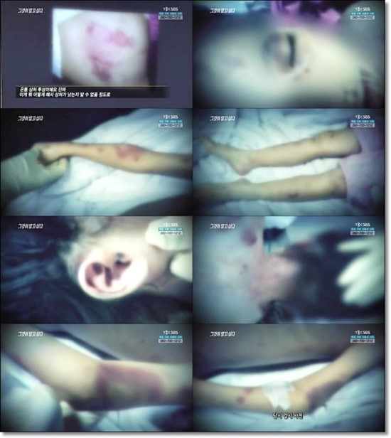 칠곡 계모 사건. SBS 그것이 알고싶다 캡처