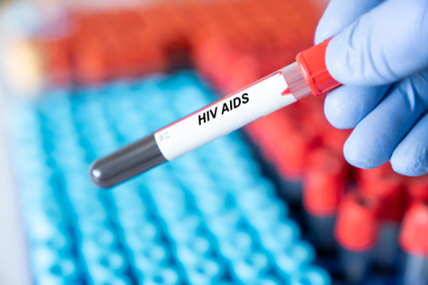 HIV 감염 숨기고, 피임 없이 성관계한 20대 男…'징역형'