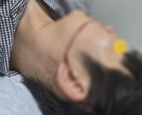 워터건에 얼굴 50cm 부상…안산 물축제 관계자 4명 송치