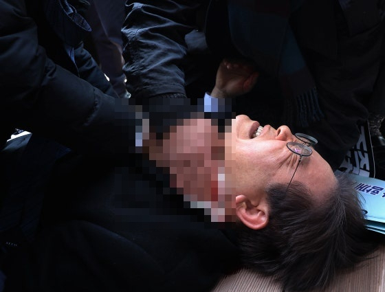 2024년 1월 2일 이재명 당시 더불어민주당 대표가 부산 가덕도 신공항 부지를 둘러본 후 기자들과 문답을 진행하던 중 왼쪽 목 부위에 습격을 당한 당시 모습. 연합뉴스