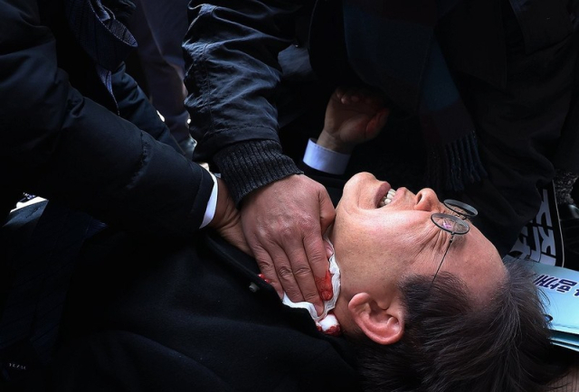 2024년 1월 2일 당대표 시절 부산 방문 일정 중 피습당한 이재명 대통령. 연합뉴스.