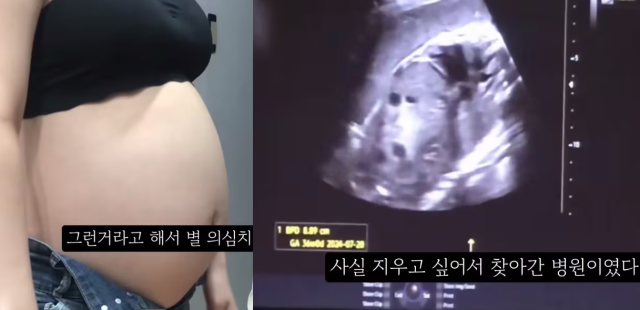 지난해 임신 36주자 태아의 초음파 사진을 공개하며 낙태 사실을 공개한 유튜브 영상. 유튜브 캡처